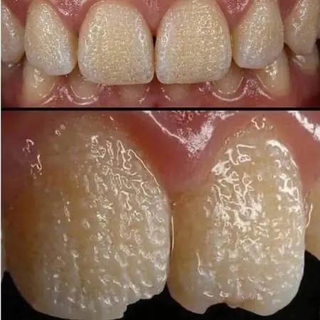 Who needs affordable dental 🪥 healthcare & go to any dentist in your