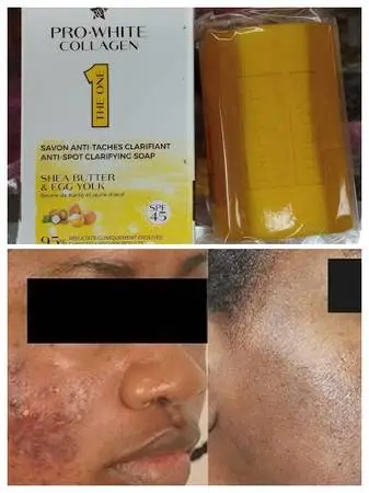 Pro-White Collagen Anti-Spot Clarifying Soap With Egg Yolk & Shea Butt